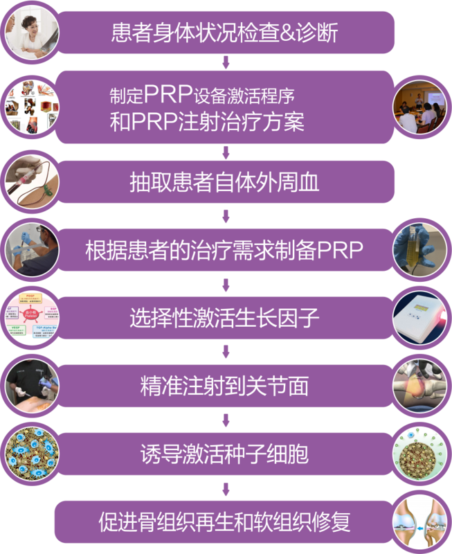 骨性关节炎,膝关节炎治疗新概念prp三折页.png